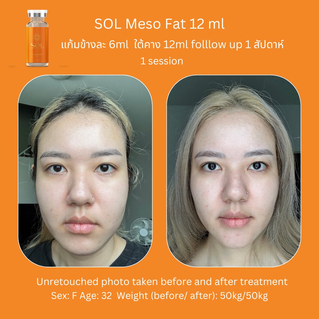 Aesthemed-sol-review-2