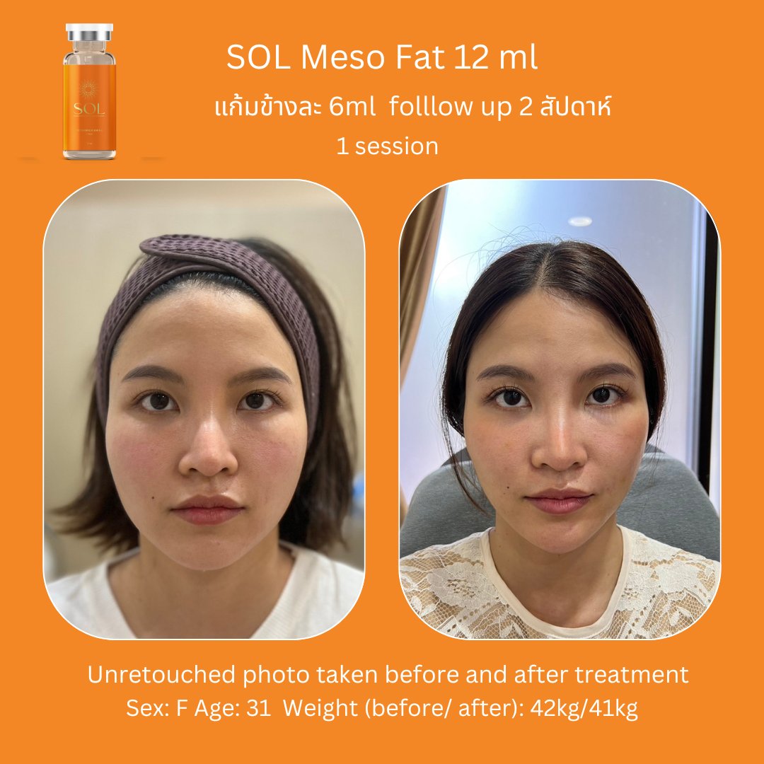 Aesthemed-sol-review-4