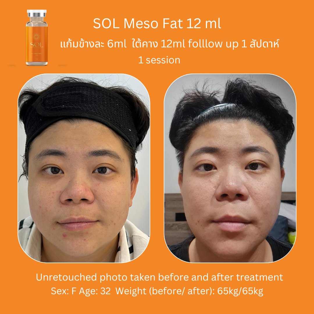 Aesthemed-sol-review-5