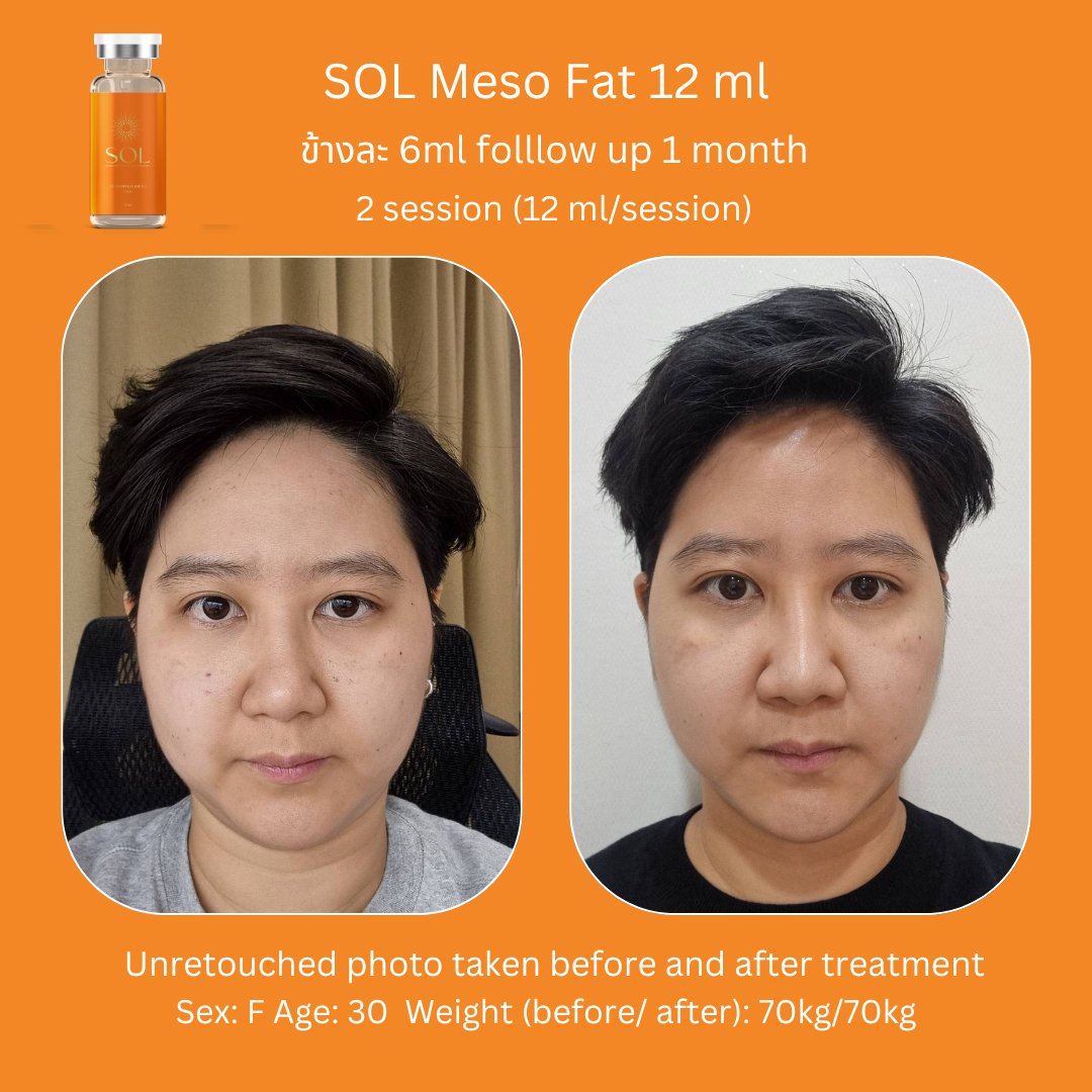 Aesthemed-sol-review-6