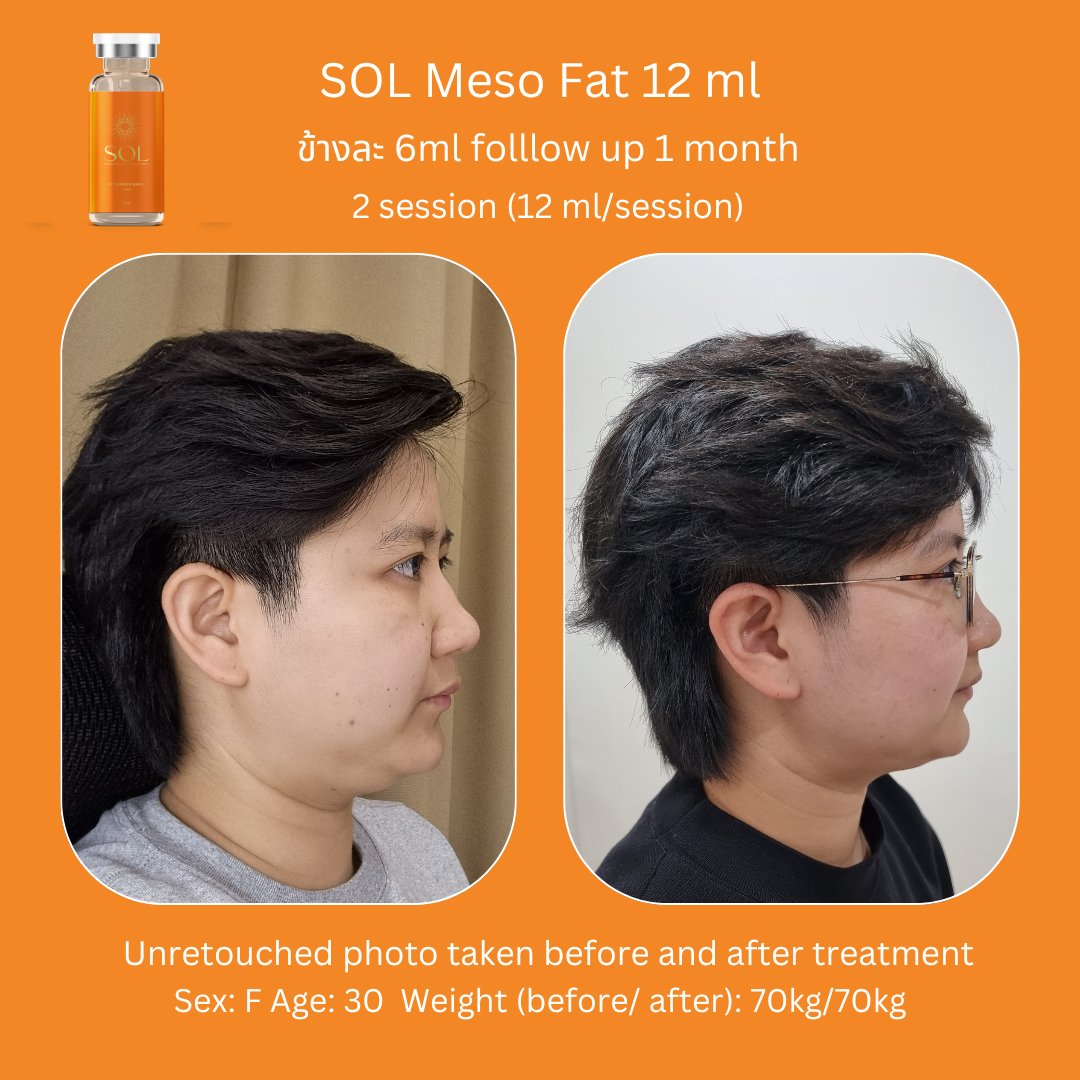 Aesthemed-sol-review-7